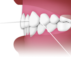 Flossing - Step 3